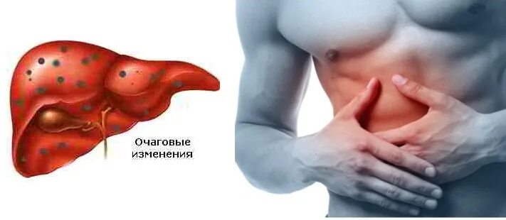 Очаги регенерации