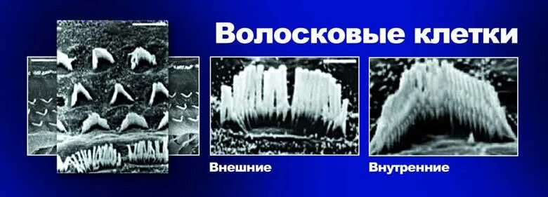 волосковые клетки