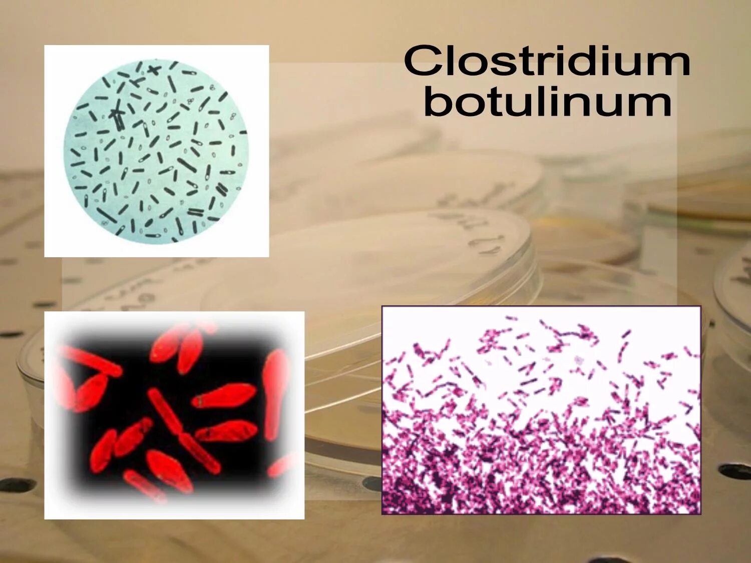 Clostridium spp. Клостридии ботулизма ( Clostridium botulinum ) ботулизм. Botulinum клостридиум. Clostridium botulinum окраска.