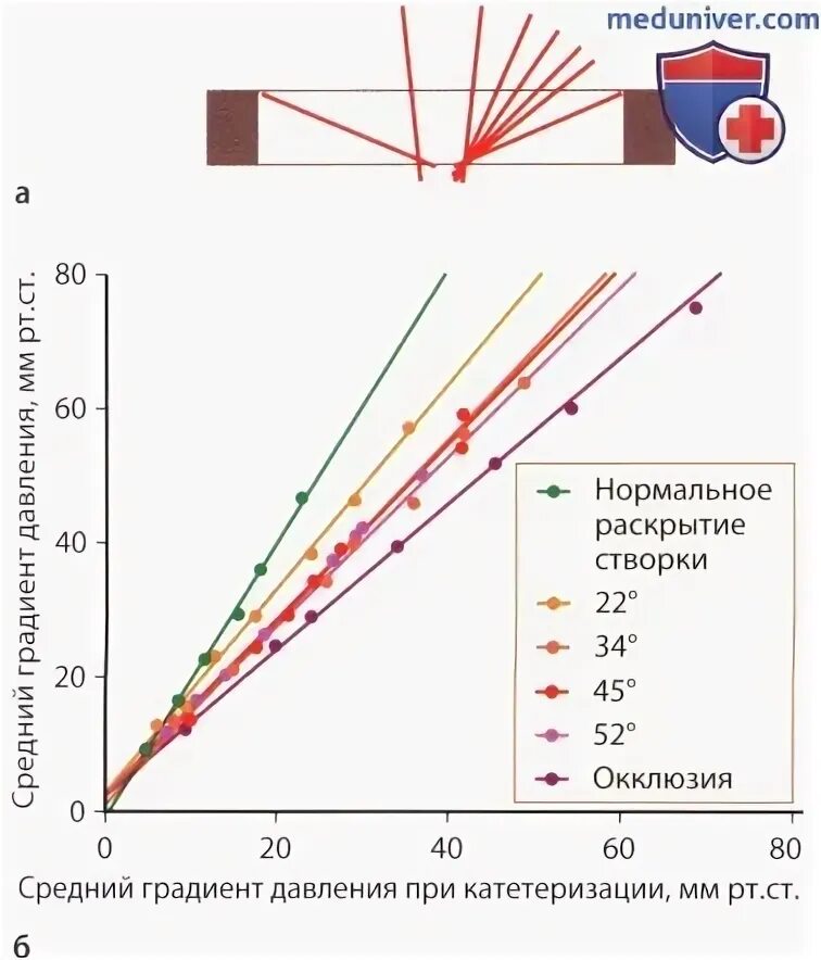 Градиент давления клапанов норма. Градиент давления клапанов норма