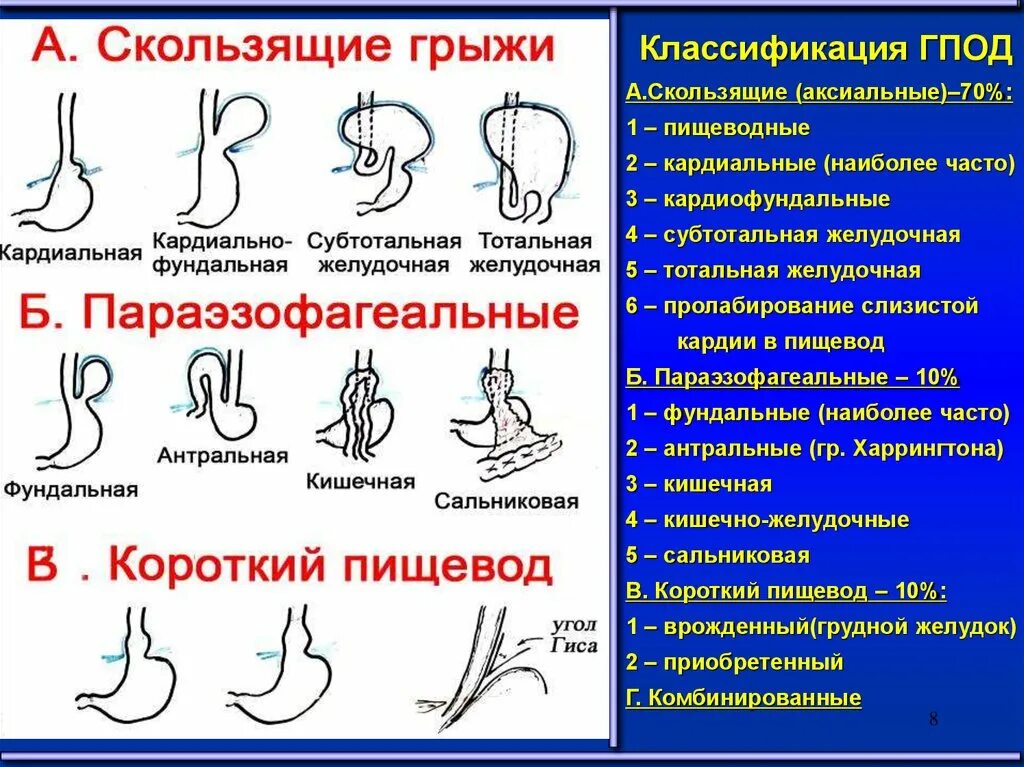 Скользящая грыжа под. Грыжи пищеводного отверстия диафрагмы классификация. Степени грыжи пищеводного отверстия диафрагмы классификация. Грыжа пищеводного отверстия диафрагмы рентген классификация. Классификация скользящих грыж пищеводного отверстия диафрагмы.