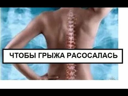Грыжа может рассосаться