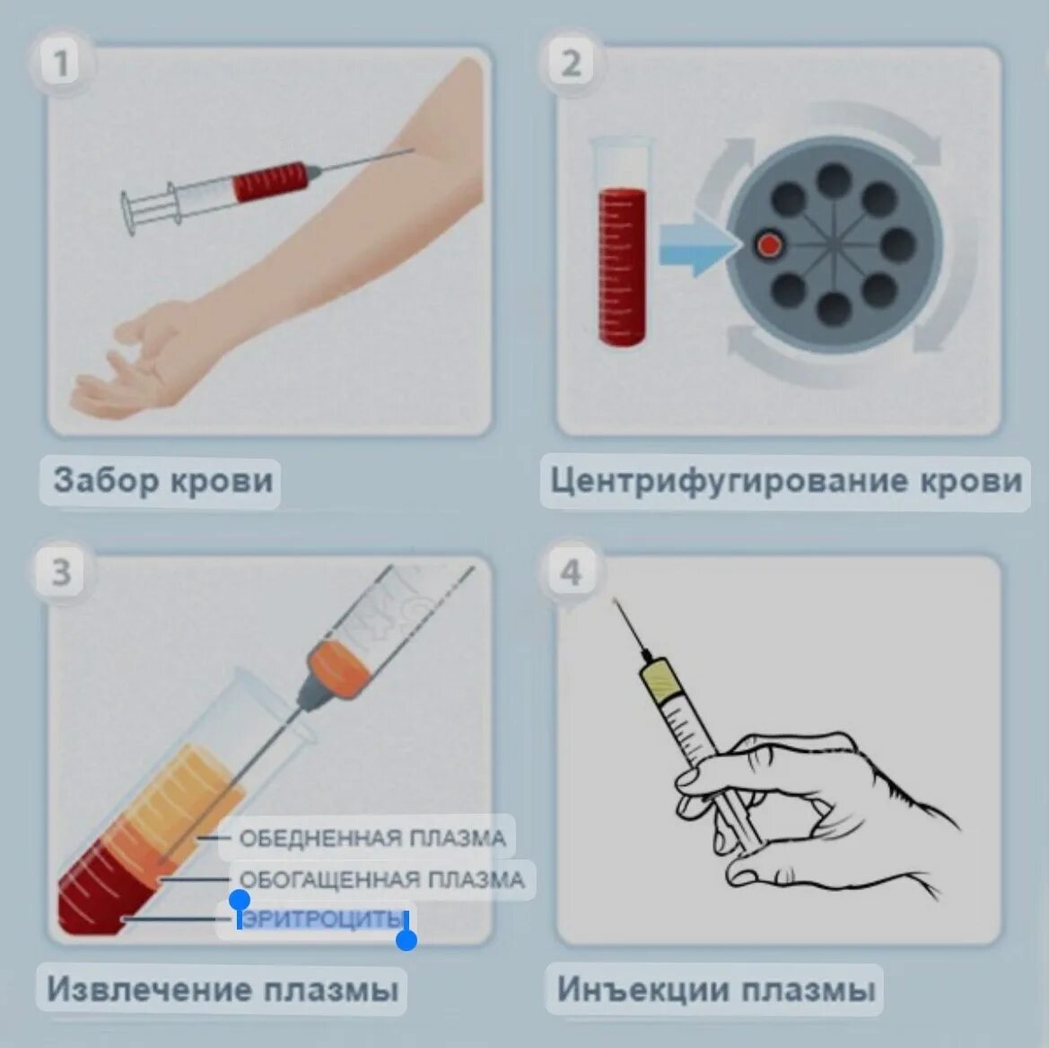 Плазмолифтинг сколько нужно процедур. Плазмолифтинг центрифугирование. Забор крови плазмолифтинг. Протокол проведения плазмолифтинга.