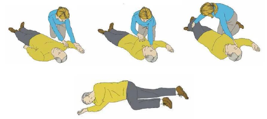 Правильное положение больного при инсульте. Помог повернуть. Вы намерены повернуть направо регулировщик. Уложить пострадавшего на спину. Помог повернуть.
