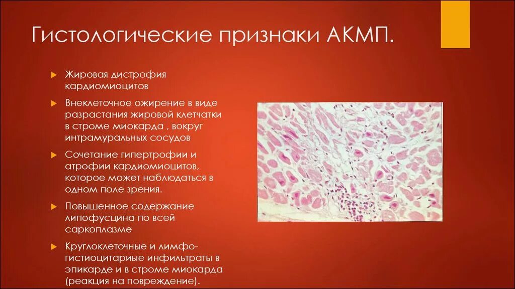 Проявления жировой дистрофии