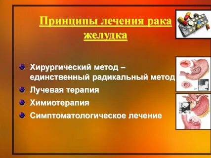 Лечение рака желудка