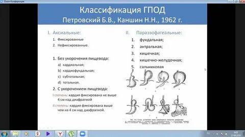 Питание диафрагмы