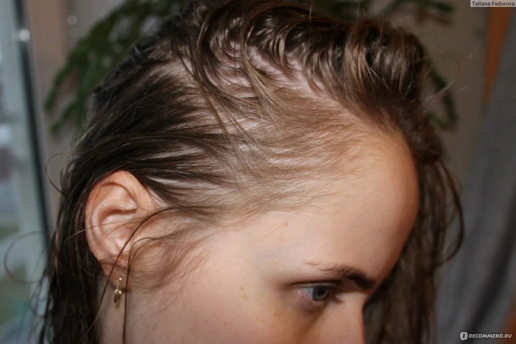 Как выглядит грязная голова. Как выглядит грязная голова. Сальные волосы. Грязные волосы. Жирные волосы.