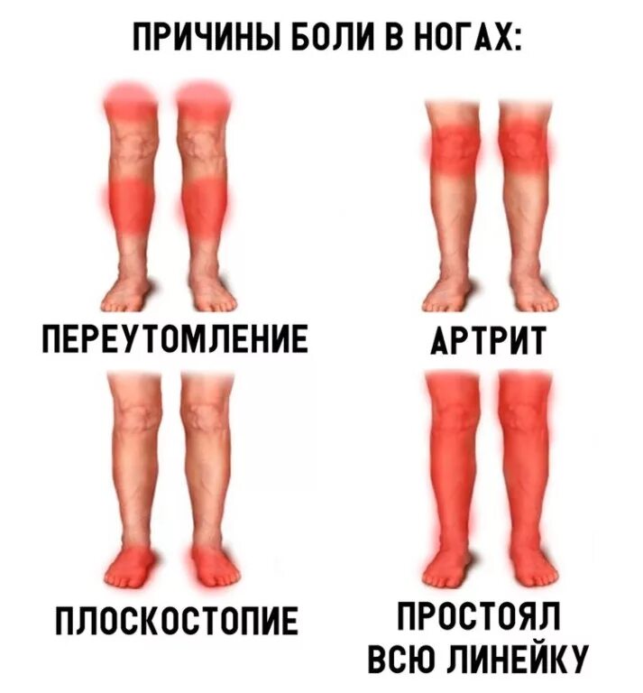 Почему ноги болят и ноют. Красные голени причины.