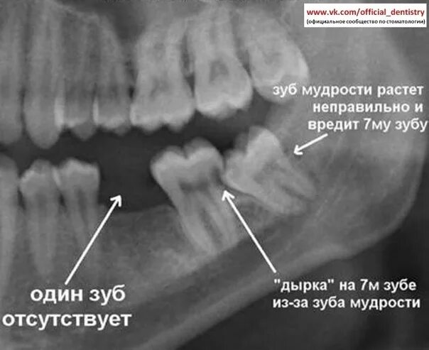 Где находится 8: найдено 18 изображений