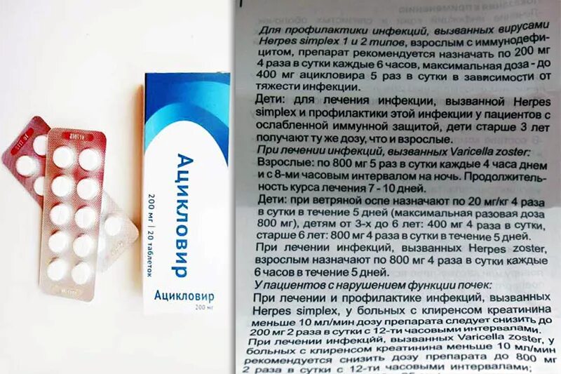 Баланопостит мкб