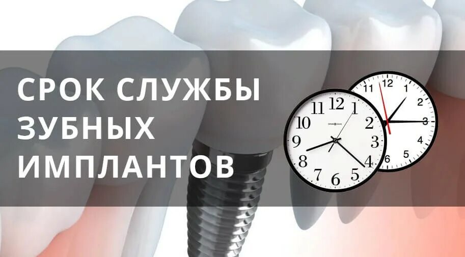 Срок импланта. Срок службы зубного имплантанта. срок службы имплантов зубов.