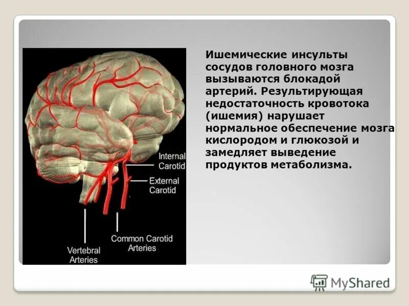 Сколько времени мозг без кислорода. Сколько времени мозг без кислорода