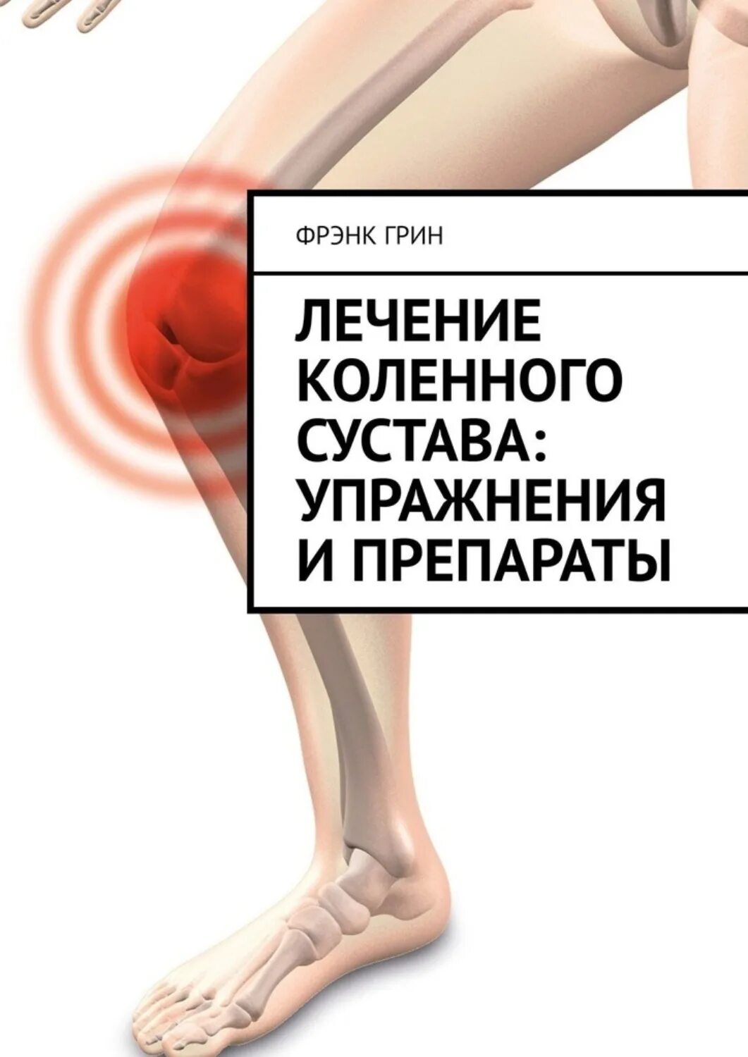 Лечение коленного сустава препараты. Книга заболевание коленного сустава. таблетки от суставной боли в коленях. остеохондроз коленного сустава. svf терапия коленного сустава.