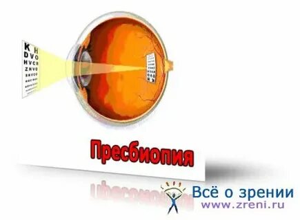 Пресбиопия капли