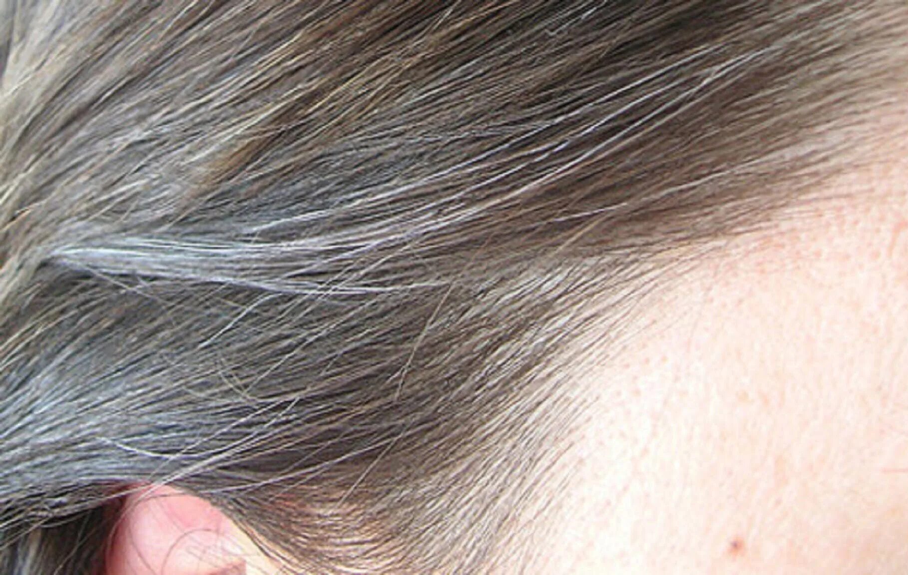 Поредение волос у ребенка. Почему волосы белеют. Седые пятна на волосах головы. Раннее поседение волос у мужчин. Седина на голове.