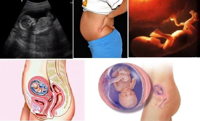 Плод на 15 неделе беременности. Расположение плода на 15 неделе беременности. Эмбрион на 15 неделе беременности. Снимок ребёнка в животе 14 неделя беременности. Можно почувствовать шевеление на 15 неделе
