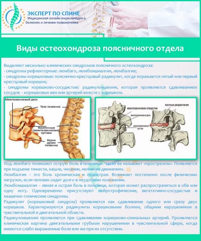 Остеохондроз 4 степени поясничного отдела симптомы. Остеохондроз пояснично-крестцового отдела позвоночника. Остеохондроз пояснично-крестцового отдела шейного и грудного отдела. Хронический хондроз поясничного отдела. Крестовой отдел позвоночника