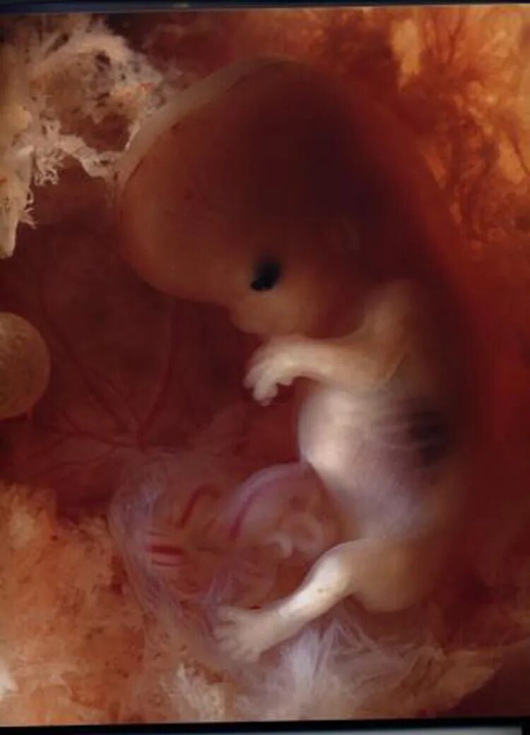 Ребенок в первые месяцы беременности. Зародыш на 5 месяце беременности. Эмбрион на 4 месяце беременности. Плод на 3 месяце беременности.