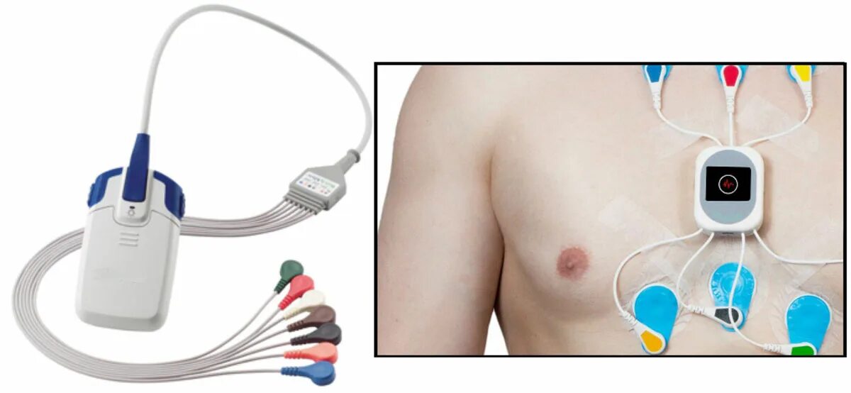 холтер экг детям. холтер ребенку. холтер экг детям. холтеровское мониторирование у детей. суточный мониторинг сердца ребенку.
