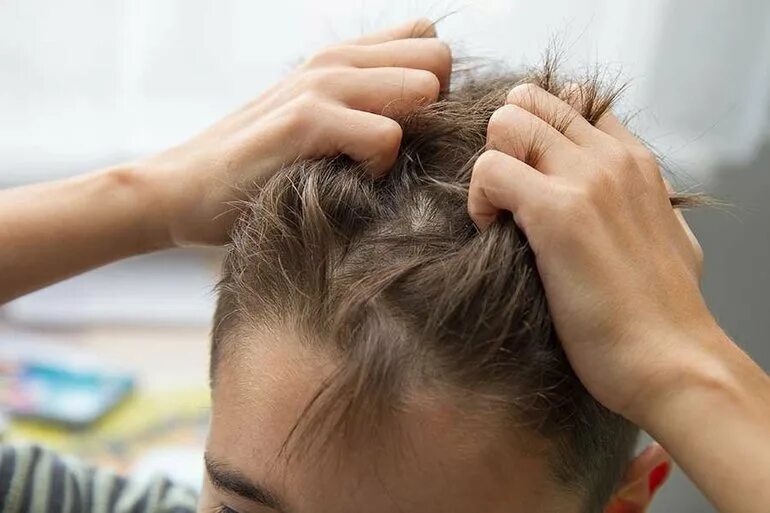 Образование на коже головы. Почему у ребенка чешется голова. Почему у ребенка чешется голова. Болят корни волос на голове. Почему у ребенка чешется голова.