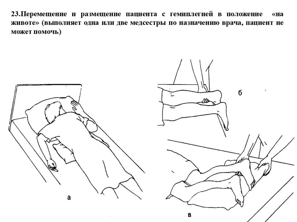 Передвижение пациента. Перемещение тяжелобольного пациента в постели алгоритм. Перемещение пациента на живот. Размещение пациента с гемиплегией в положение на животе. Положение лежа на животе алгоритм.