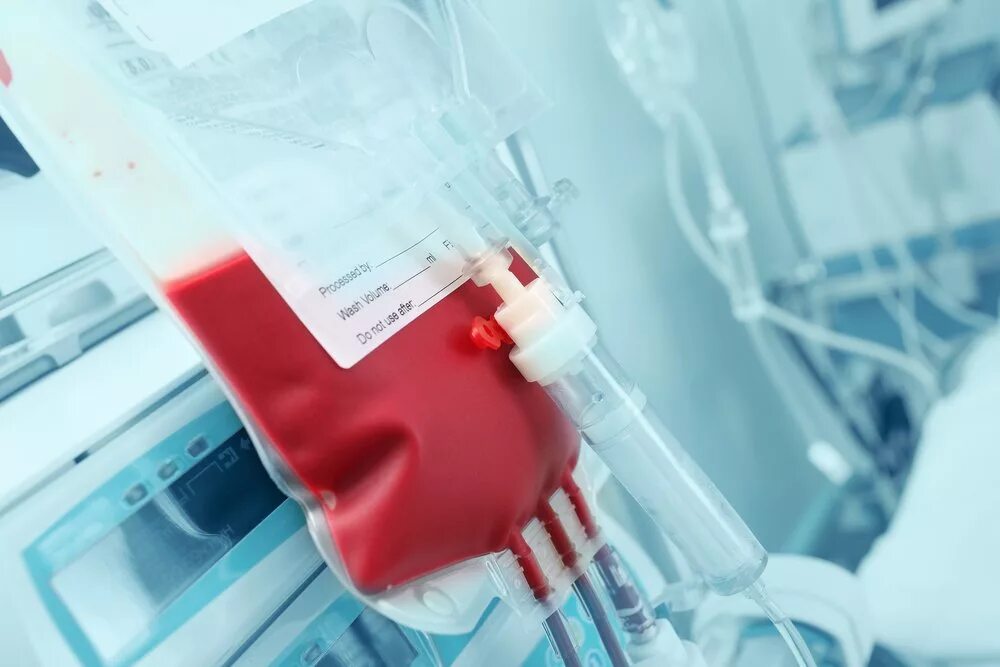 Донорство цельной крови. Переливание донорской крови.