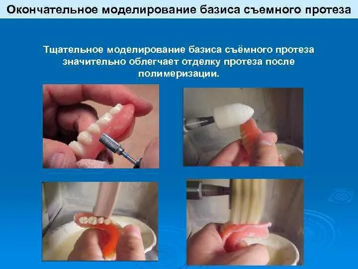 Сотрудники базиса. Окончательное моделирование базиса протеза. Окончательное моделирование восковой конструкции протеза.
