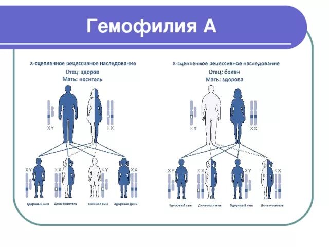 Наследование по отцу семья. Схема наследования гемофилии. Болезнь гемофилия Тип наследования. Схема передачи гемофилии. Схема наследования гемофилии у человека.