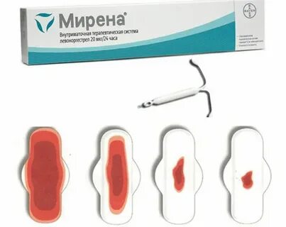 Месячные после спирали форум