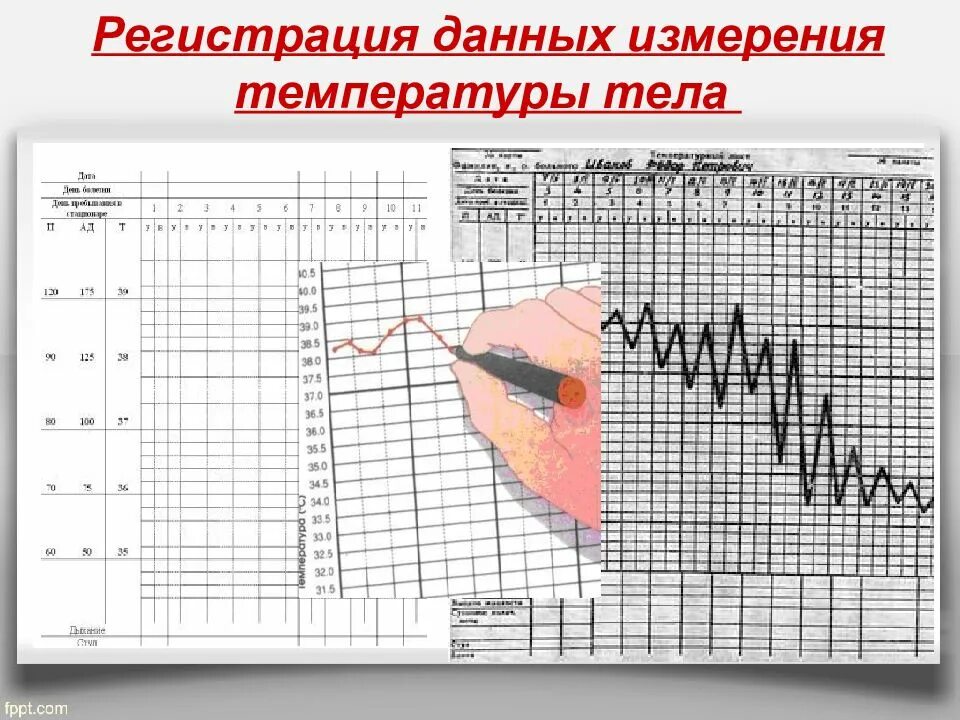 Манипуляция температуры тела. Температурный лист. запись в температурный лист. регистрация данных измерения температуры тела в температурном листе. регистрация показателей в температурном листе.