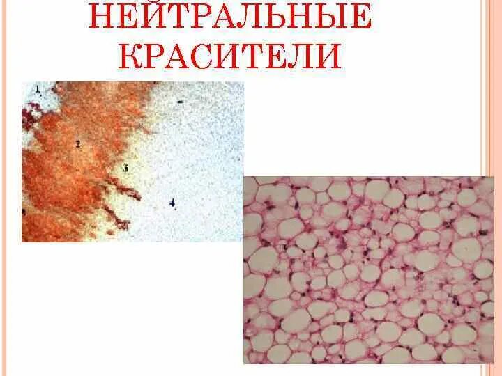 Красители в гистологии. Нейтральные красители в гистологии. кислые и основные красители гистология. красители гистологических препаратов.