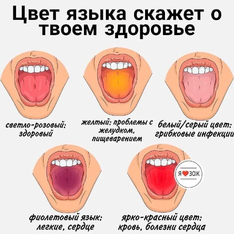 Как определить больной орган. Цвет языка о чем говорит. Здоровье по цвету языка. Цвет налета на языке о чем. Заболевания по цвету языка.