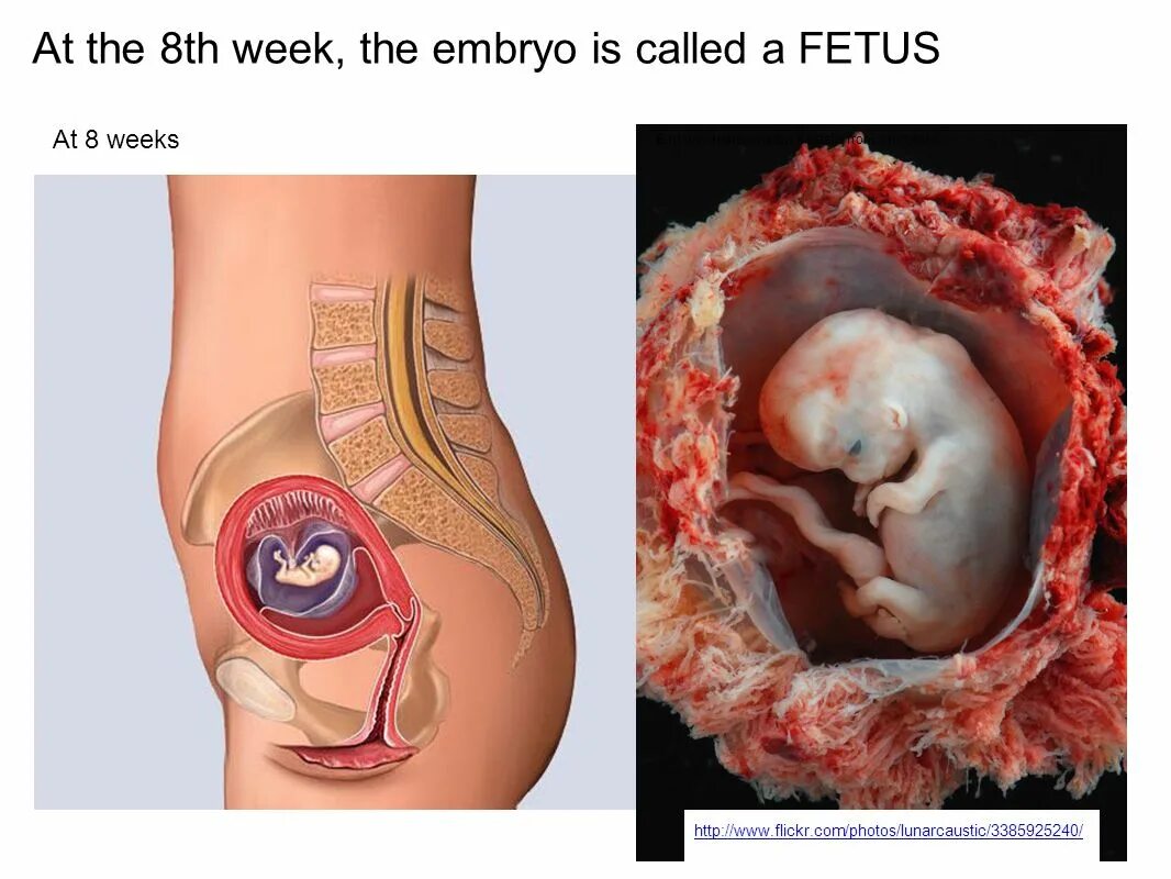Ребёнок на 8 неделе беременности. Плод на 8 неделе беременности. Где расположен ребенок на 8 неделе. Ребенок на 7-8 недели беременности. Выпила в 8 недель