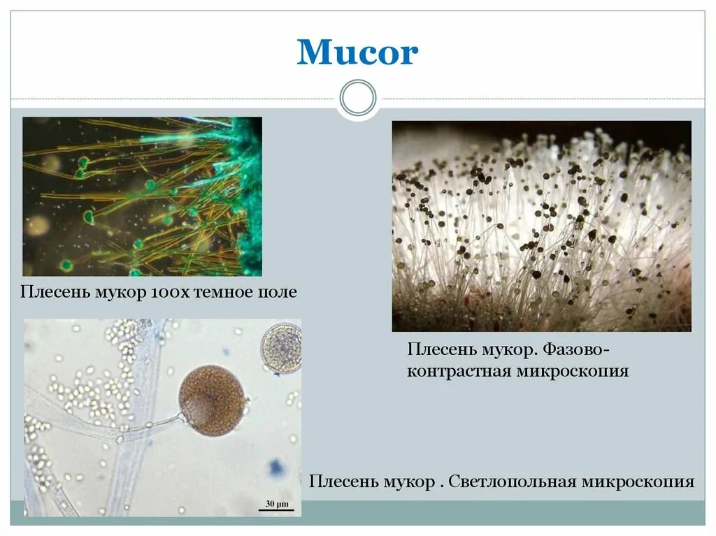 Мукор животное. Мукор синцитий. Плесневые грибы рода Mucor. Микроскопические грибы микроскопия. Мукор колонка.