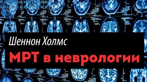 Мрт неврология одинцово