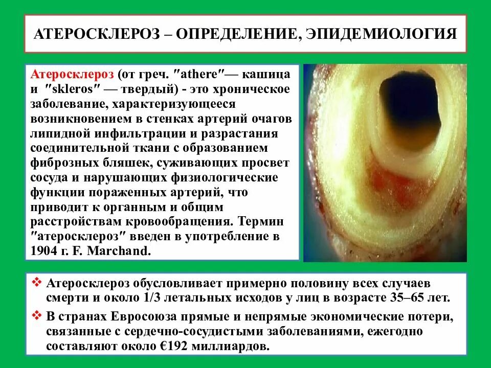 Артериосклероз. Эпидемиология атеросклероза. атеросклероз определение. артериосклероз и атеросклероз определение.