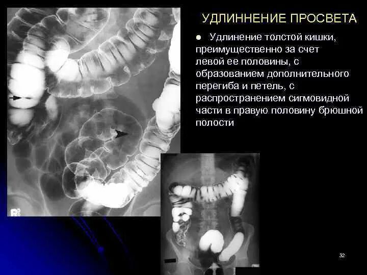 КГМУ Кафедра общей хирургии Травмы живота Актуальность
