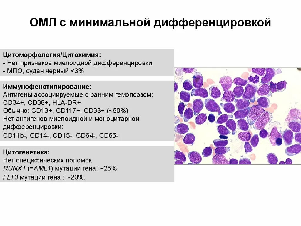 Мозг при остром лейкозе. Острый монобластный лейкоз уитохимич. Острый миелобластный лейкоз картина крови. Острый миелобластный лейкоз (ОМЛ). Острый миелоидный лейкоз иммунофенотипирование.