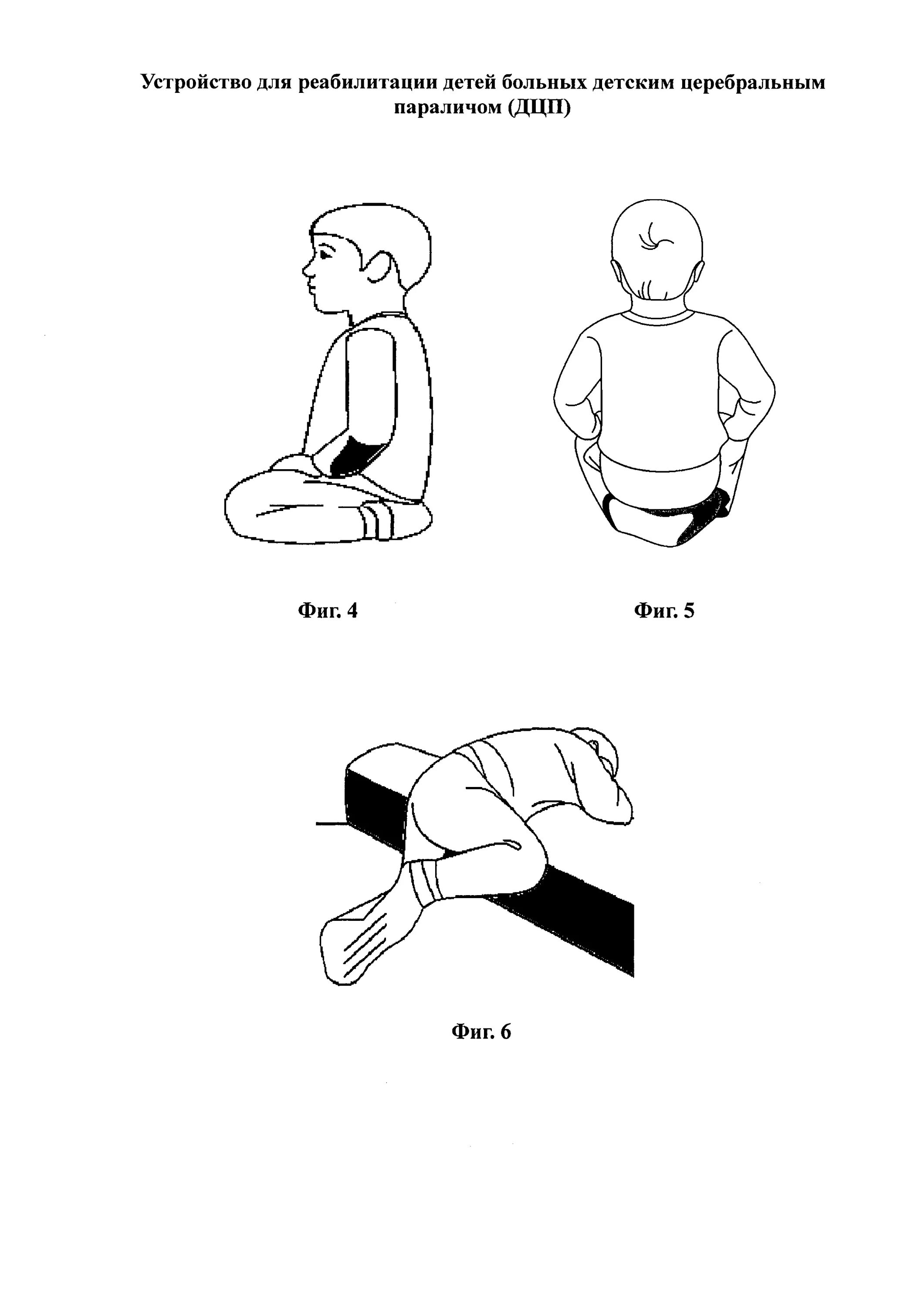Позиционирование детей с ДЦП. ЛФК для детей с ДЦП упражнения. Лечебная физкультура при ДЦП У детей. ЛФК при ДЦП комплекс упражнений для детей. W поза у ребенка