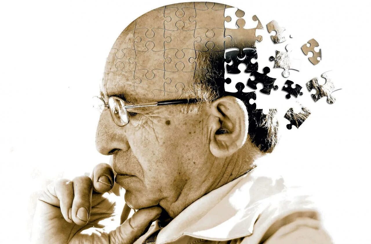 Развивающееся слабоумие. Деменция Альцгеймера. Альгеймер. Люди с Альцгеймером. Психология старости.