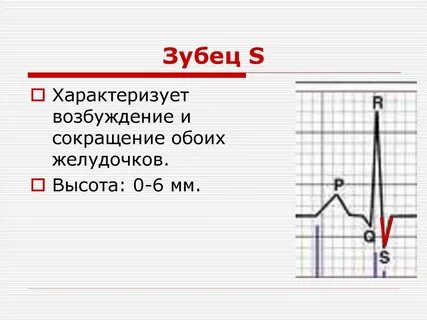 1 секунда на экг