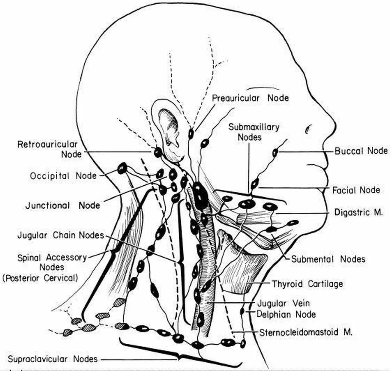 Схема лимфоузлов головы. Лимфатическая система человека схема голова. Схема лимфоузлов шеи кт. Сосцевидные лимфатические узлы схема.