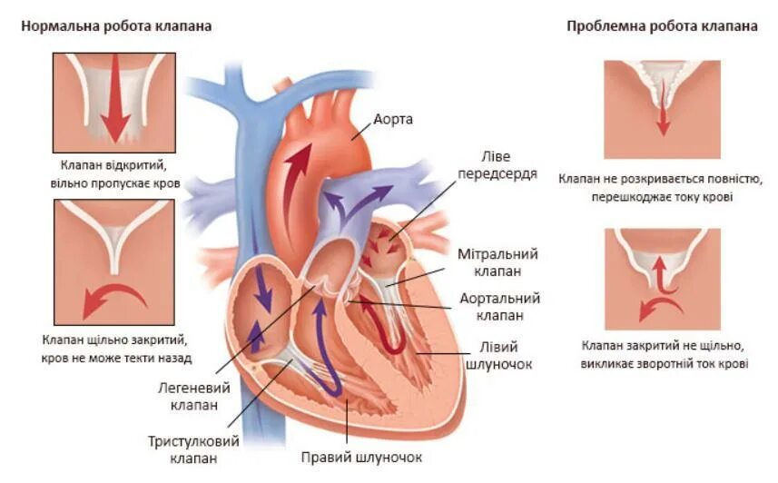 Поражение митрального клапана. Митральный клапан и аортальный клапан. Митральный аортальный трикуспидальный клапан. Трехстворчатый аортальный клапан сердца. Митральный клапан и трикуспидальный клапан.