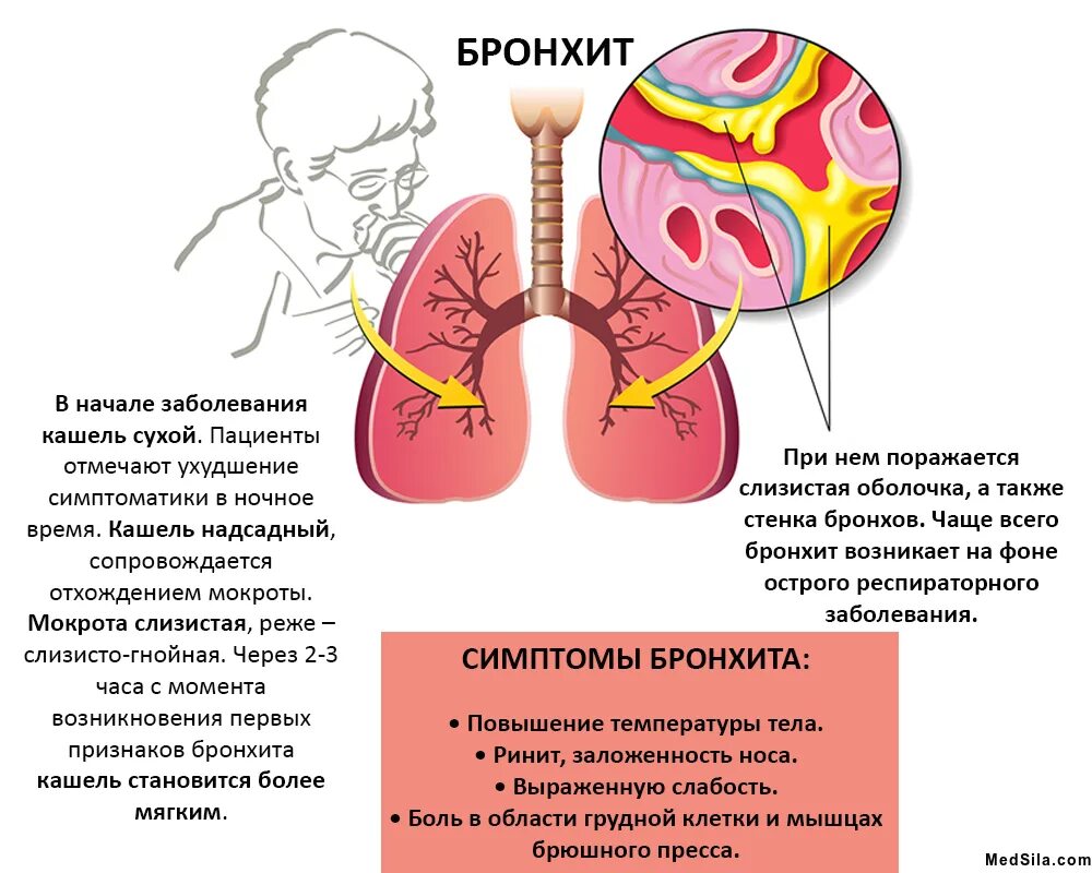 Сухая мокрота в легких