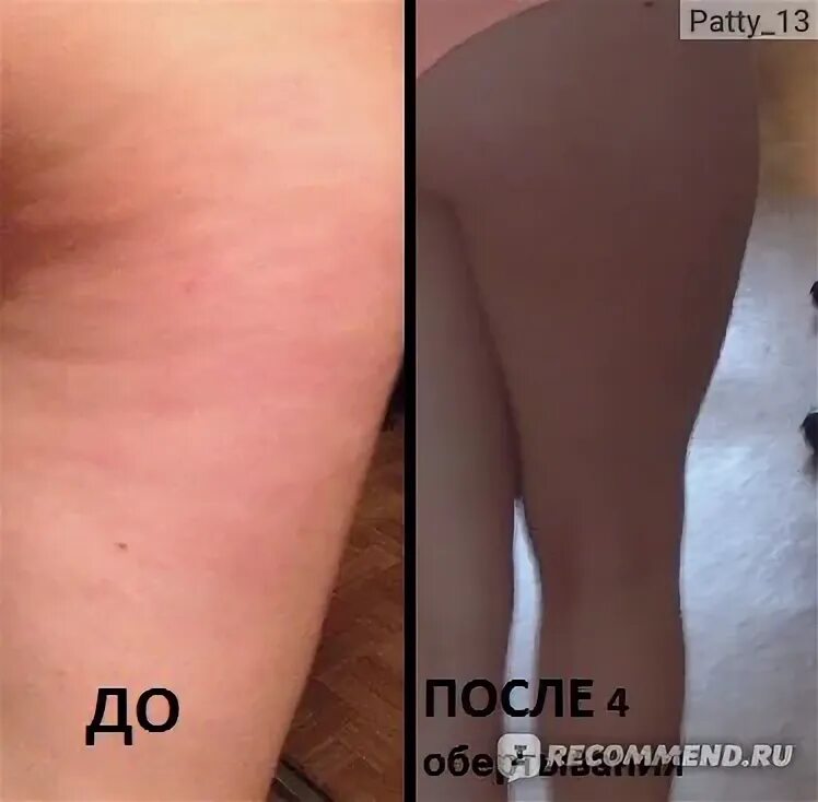 Медовый массаж до и после. Обертывание до и после. Обертывание для похудения до и после. Обертывания от целлюлита до и после. Водорослевое обертывание до и после.