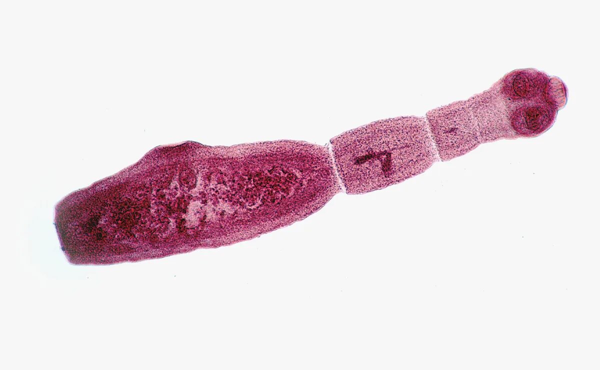 Чем опасен эхинококк для человека. Ленточные черви эхинококк. Ленточный червь эхинококк. Ленточного гельминта эхинококка. Плоские черви ленточные эхинококк.