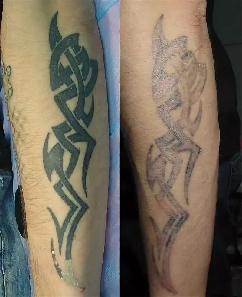 Татуировки спустя время. Тату выцветает. Татуировки через несколько лет. Тату которые выцвели.