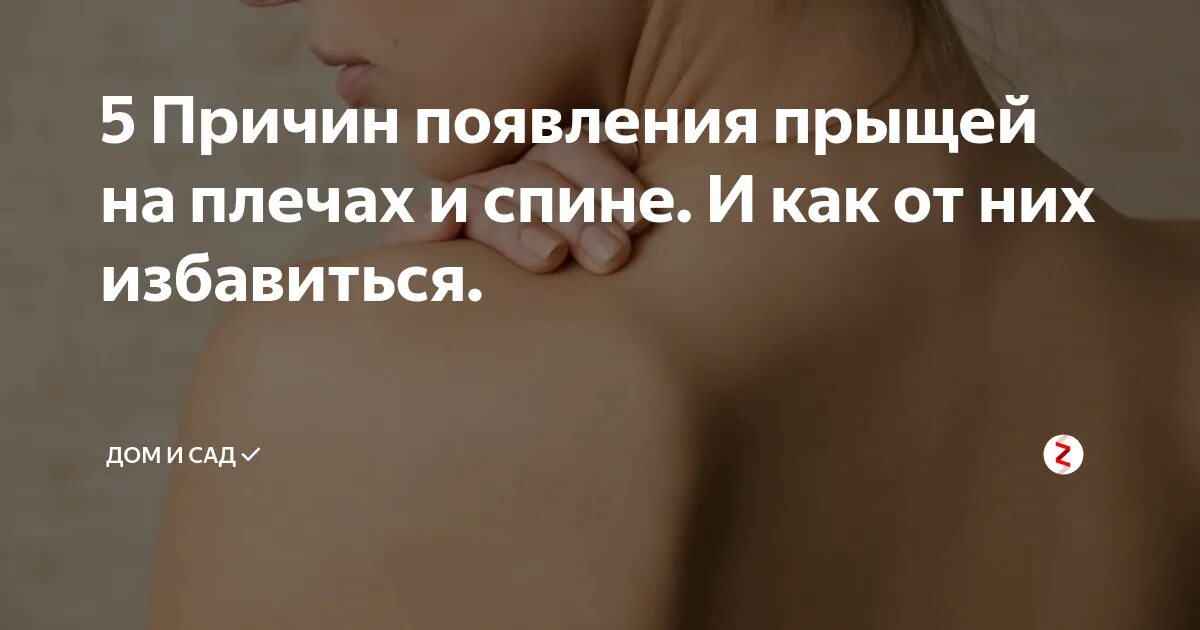 Причины появления прыщей на спине. Причины появление угрей на спине. Появление прыщей на спине. Причины возникновения прыщей на спине. Прыщ на правой стороне примета