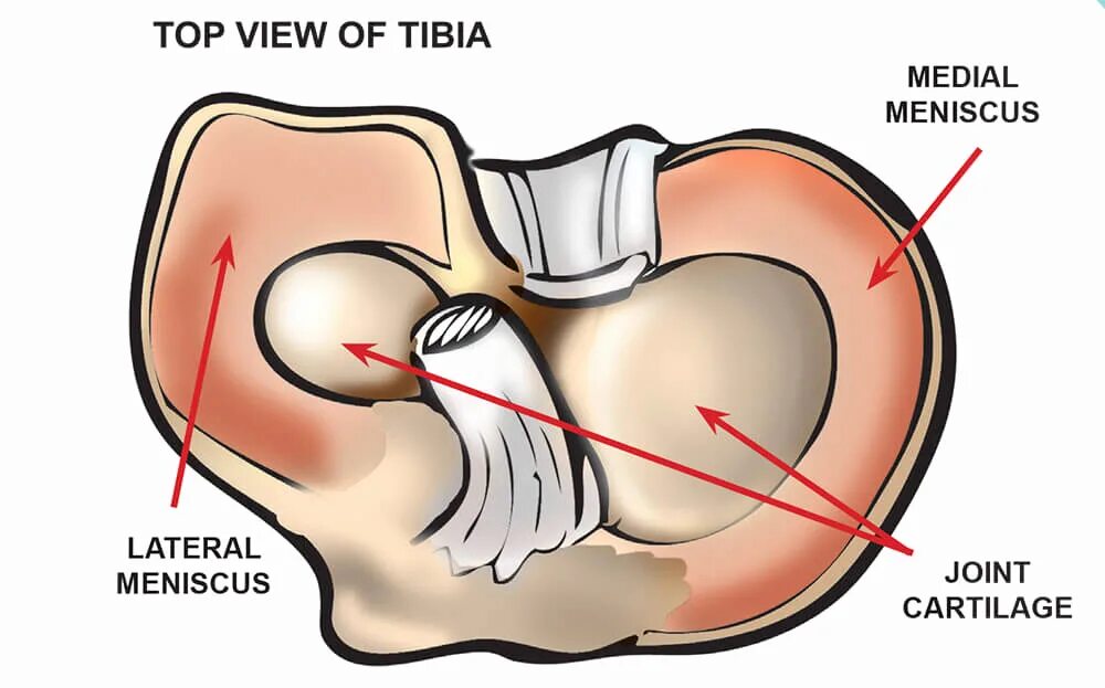 Мениск анатомия разрыв. Мениски коленного сустава анатомия. Мениски колена анатомия. Мениски коленного сустава анатомия разрыв.